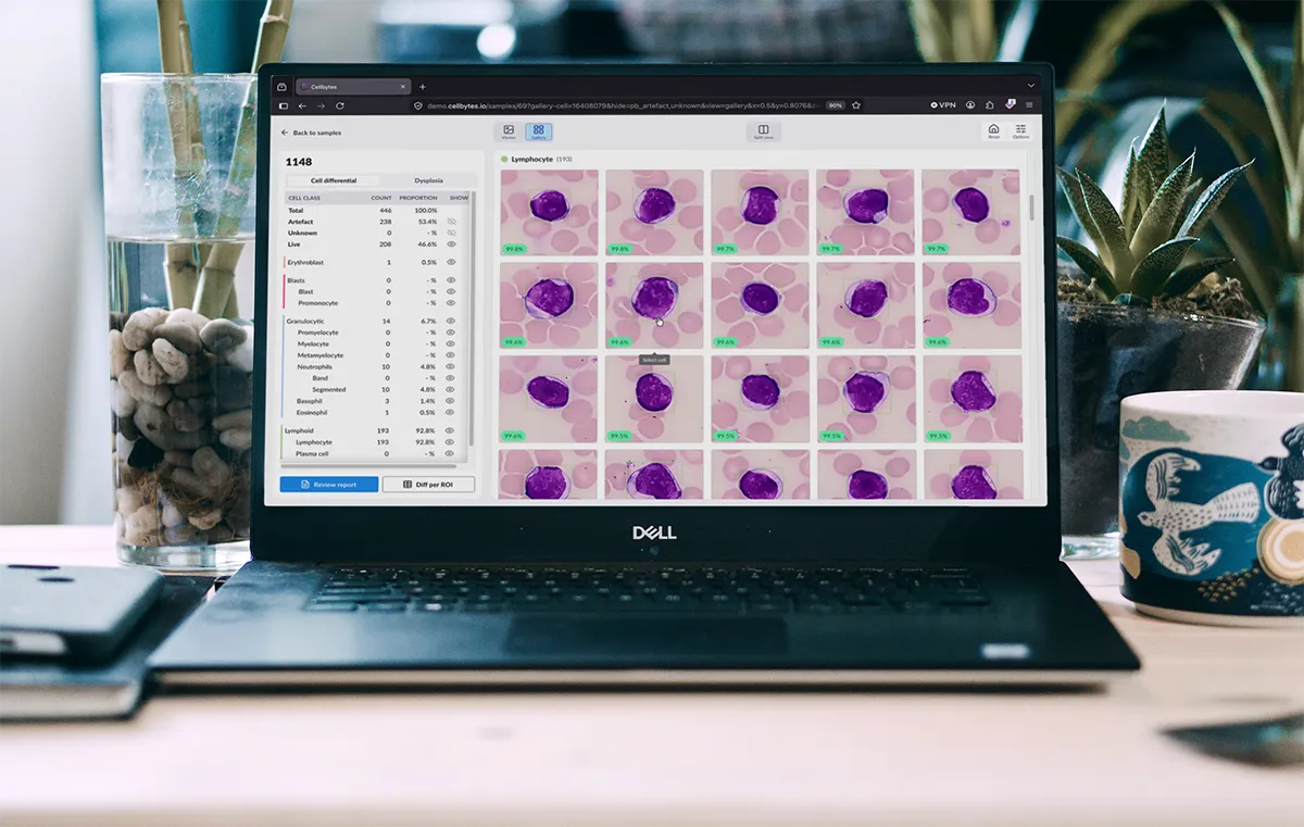 A laptop on a desk showing a cell gallery in Cellbytes.